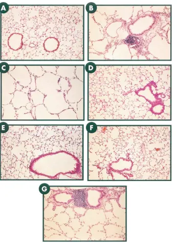 Figure 5. Comparison of the airway and alveolar phenotype of CC10-IL-11 and CC10-rtTA-hIL-11 animals when trans-gene activation was initiated in utero and maintained for 2 mo