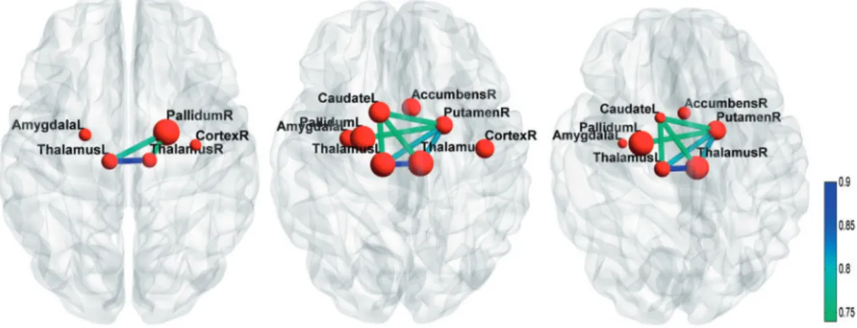 Fig. 2. Subcortical network signatures for age-at-onset of HD using PREDICT baseline imaging data estimated by local adaptive network [AlocNet]