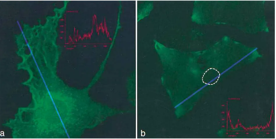 Figure 4. Morphologic analysis of human aortic SMC. (a) Quiescent SMC, stained with rabbit polyclonal anti–human sTF antibody, demonstrat-ing granular perinuclear and edge staining (peroxidase; 400� original)