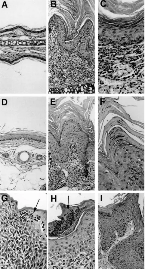 Figure 5. Histopathology of founder K14-ARGE transgenic mice. Tissue was processed for H and E staining as described in Methods