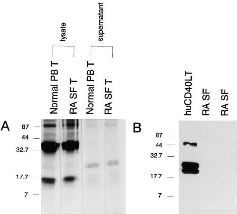 Figure 9. Production of soluble CD40-L by RA SF T cells. (TRANSlabel. CD40-L immunoreactive protein was purified by im-munoprecipitation with CD40-Fc