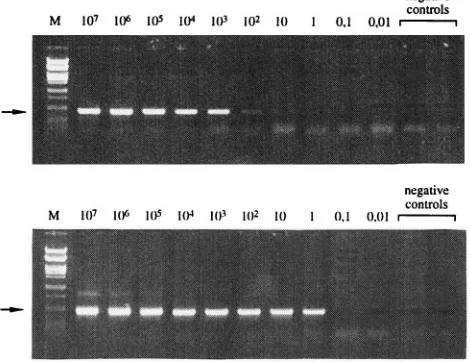 FIG. 4. Sensitivity of PCR assay for the detection of V. choleraeby a single PCR (A) and with nested primers (B) evaluated with a serially dilutedbacterial lysate, in numbers of CFU per assay