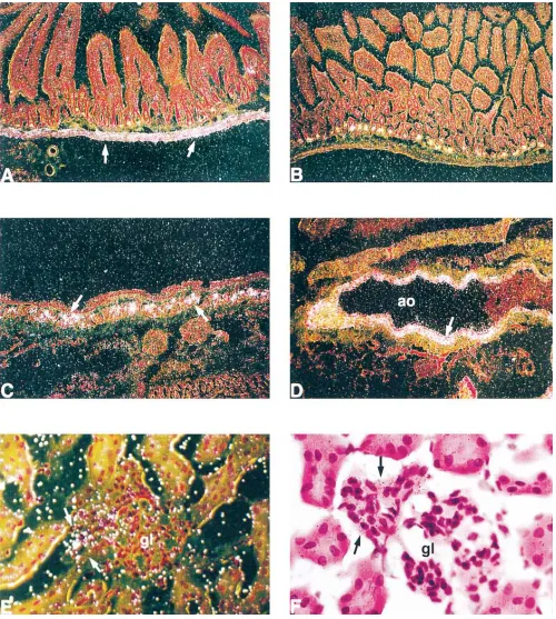 Figure 7. Expression of the IGF-I transgene in SMP8–IGF-I transgenic mice. (been hybridized with the antisense probe for SV40