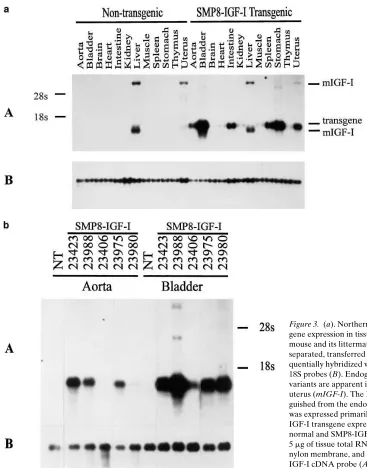Figure 3. (a). Northern blot analysis of SMP8-IGF-I trans-gene expression in tissues from a representative transgenic mouse and its littermate