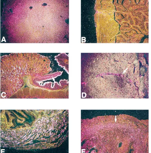 Figure 6. In situ hybridization of SMP8–IGF-I mice and nontransgenic controls. (sion is diffuse in hepatocytes