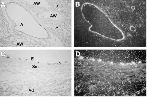 Figure 4. Western blot analysis for eNOS. Human endothelial cell protein (six different experiments