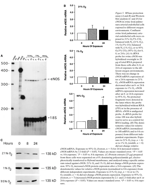Figure 5. RNase protection 