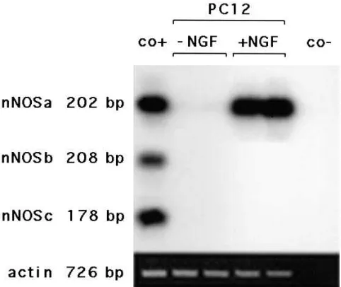 Figure 2. Analysis of expression by RNase protection assay. Expression patterns of nNOSa (ing 100 A), nNOSb (B), and nNOSc (C) were examined us-�g total RNA from heart (H), testis (T), adrenal (A), intestine (I), kidney (K), brain (B), skeletal muscle (M),