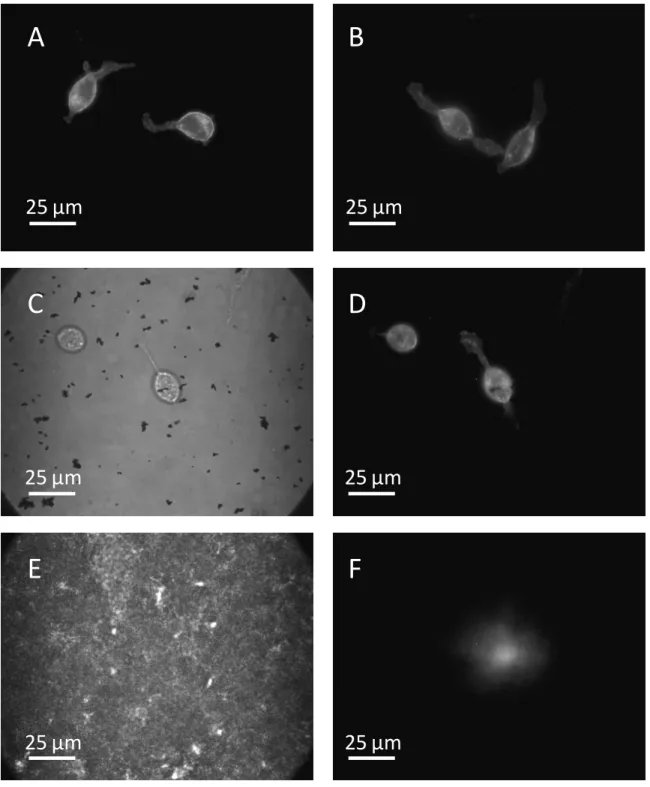 Figure 2.7  Fluorescence  images  of RBL  cells  stained with  Alexa Fluor 647-labeled  IgE  cultured on  glass (A) or  a  5-µm  thick film  of SU8 containing 1% uniformly distributed  maghemite nanoparticles (B)