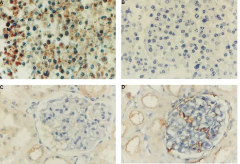 Table I. ED-1–Positive Cells per Glomerular Cross-section 4 d After Infusion