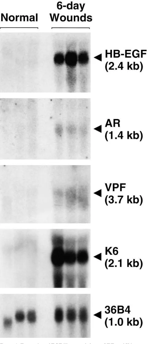 Figure 6. Expression of EGF-like growth factor, VPF, and K6mRNAs in normal and wounded skin