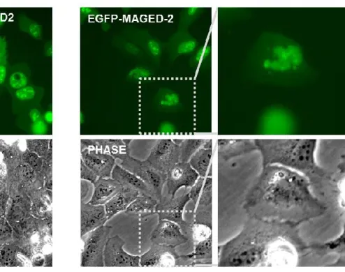 Figure  3-5.  Expression  of  EGFP-tagged  MAGE-D2  is  toxic  to  cells  and  disrupts nuclear and nucleolar morphology