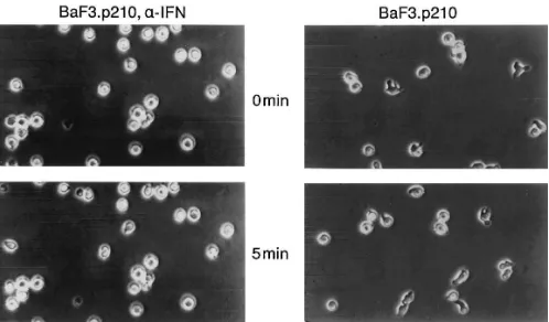 Figure 9. �-interferon retards hypermotility of BCR/ABL expressing cells and reverts the morphology of leukemic cells back to normal