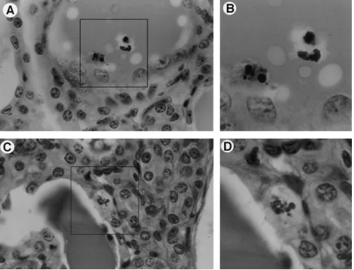 Figure 1. Identification of apoptotic epithelial cells in adult transgenic mouse kidneys with HIVAN