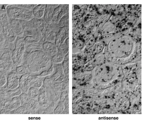 Figure 2.Identification of apoptotic cells in transgenic mouse kid-neys by TUNEL assay