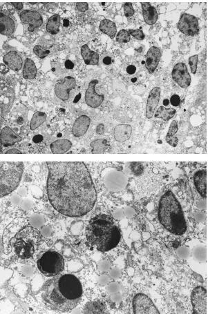 Figure 6. Electron micrographs of HIV-1 transgenic Original magnification of 1,600. (kidney cultures after UV treatment