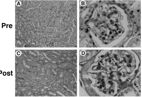 Figure 8. Histology of residual kidney of normal mouse and the contralateral kidney that was transplanted into a transgenic mouse