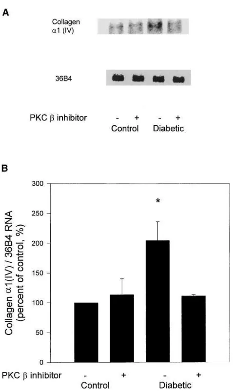 Figure 9. Effect of PKC and 36B4 RNA in lower panel. (RNA probed with cDNA for mouse body wt) on 12-wk diabetes-induced type IV collagen mRNA expres-sion in glomeruli