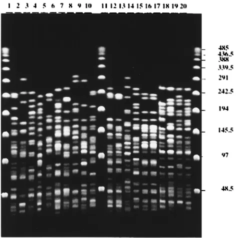 FIG. 3. 16S rRNA proﬁles of Y. pseudotuberculosis1 strains; lanes 6 to 9, serotype 2 strains; lanes 10 to 12, serotype 3 strains; lanes 13 and 14, serotype 4 strains; lanes 15 and 16, serotype 6 strains; lanes 17 to 20,