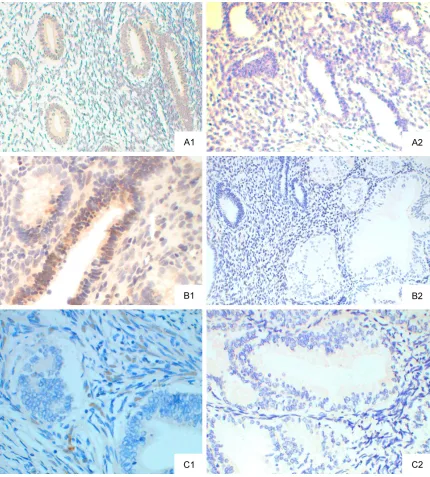 Figure 2. p-ERK1/2 protein expression (SP method; ×20). A: normal endometrium; A1: p-ERK1/2 positive; A2: p-ERK1/2 negative; B: EAH; B1: p-ERK1/2 positive; B2: p-ERK1/2 negative; C: EEC; C1: p-ERK1/2 positive; C2: p-ERK1/2 negative.