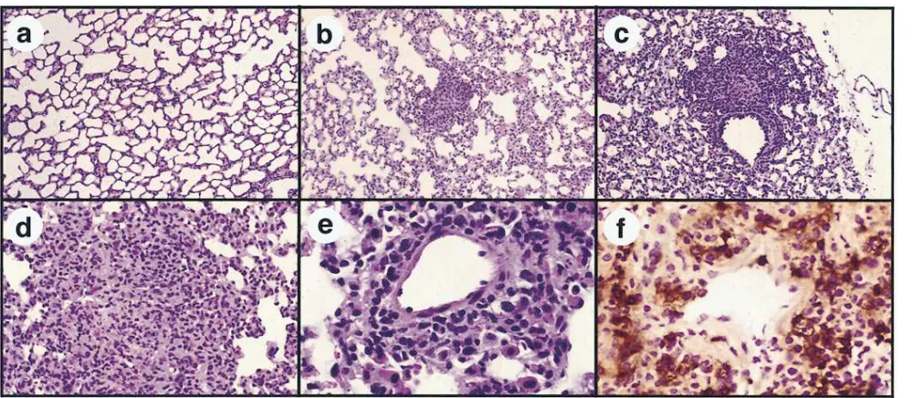 Figure 5. Intramuscular injection of SAg plasmid DNA induces a strong mononuclear cell inflammatory response