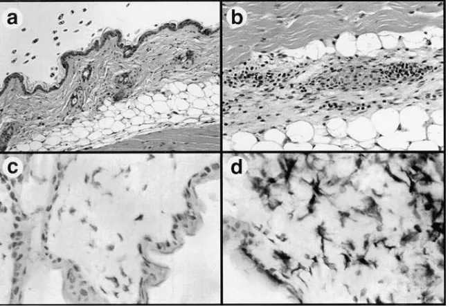 Figure 6. Intradermal SAg DNA injection in-duces epidermal infiltration of CD4� T cells