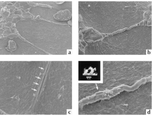 Figure 8. Representative scanning electon micrographs revealing HDMEC capillary tube morphology