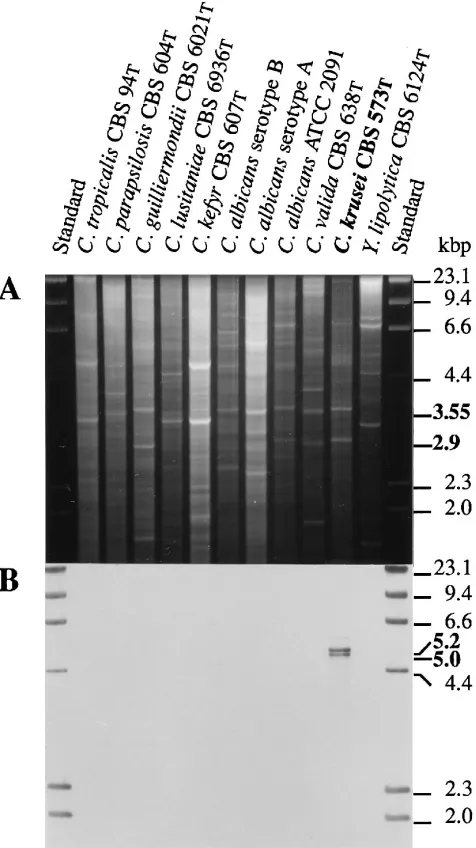 FIG. 1. Southern blot analysis of Candidaresed on a 0.8% agarose gel at 40 V for 18 h, stained with ethidium bromide, andphotographed (A) prior to being blotted on positively charged nylon membrane.The blot was probed with about 100 ng of peroxidase-labele