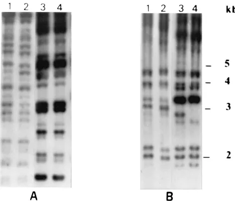 FIG. 1. Autoradiogram of Ecorespectively. (B) Lanes 1 to 4 show proﬁles generated from isolates BBproﬁles generated from two single-colony isolates recovered from the same CSFsample during the initial and recurrent episodes of infection, respectively