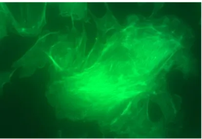 Figure 2.4.2. Bovine pulmonary artery endothelial cell images tagged with its  appropriate  fluorophore  (MitoTracker  Red  CMXRos,  Alexafluor  488  phalloidin)  collected  with  Kahle’s  inverted  fluorescence  microscope  setup