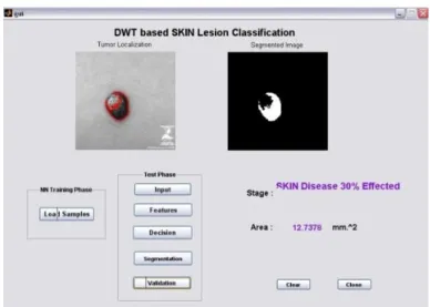 Table  III:  The  table  illustrates  performance  metric  comparison for without DCT/DWT, DWT and DCT for a 30  percent skin effected image 