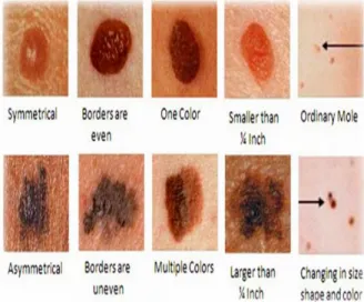 Fig: 1 Different pattern of skin lesions 