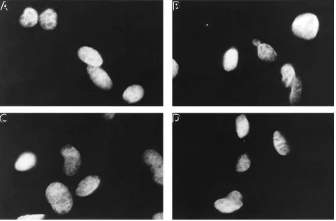 Figure 11. Protein stabilizers appear to correct the folding defect of the newly synthesized, but not the mature, form of the E1 enzyme