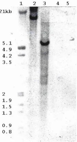 Fig. 3.3: Southern hybridisation of the DIG labelled Bacillusgene against erythropolisRhodococcus NHase a  subunit R