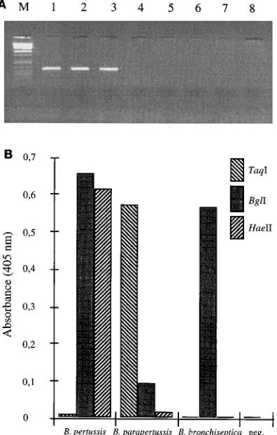 FIG. 4. Detection limit of the nested PCR, evaluated on a bacterial lysate. Lanes 1 to 3, 600 CFU of bacteria; lanes 4 to 6, 60 CFU; lanes 7 to 9, 6 CFU; lanes 10to 12, 0.6 CFU; lanes 13 to 15, 0.06 CFU; lanes 16 and 17, negative PCR controls.