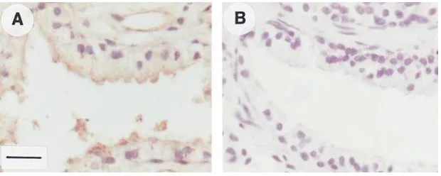 Figure 3. Cross-linking of 