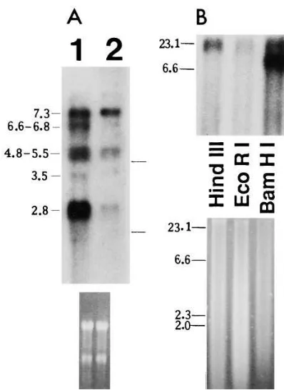 Figure 7. Northern and Southern blot analyses showing the short Prl used. The positions of rRNAs (18S, 28S) are marked, and the corre-sponding ethidium bromide staining of the blot is shown to verify the loading and transfer of RNA (receptor mRNAs