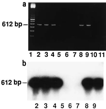 Figure 9. Demonstration of Prl mRNA expression in human pros-transcriptase were used as negative controls