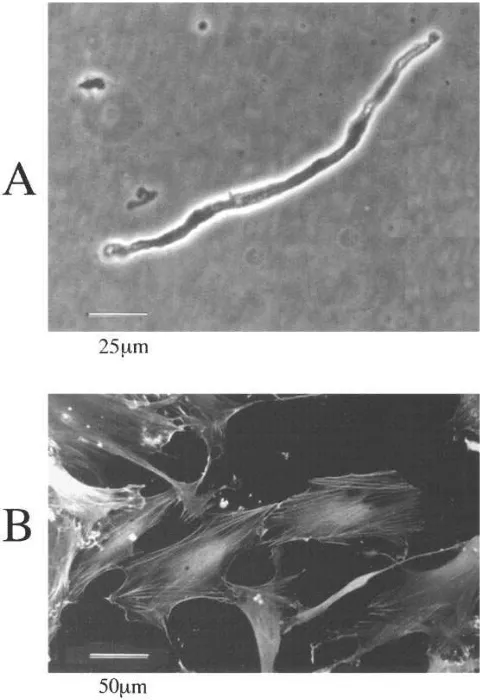 Figure 1. Freshly isolated and cultured human coronary myocytes. Photographs of (A) a single freshly isolated and (B) cultured myo-cytes with immunodetection of �-SM actin (5 d after plating; see Methods).