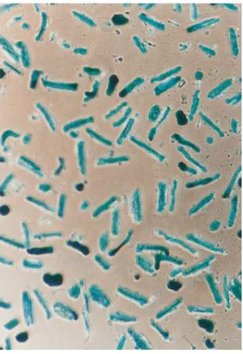 Figure 2. Expression of recombinant adenoviral transgenes in adult rabbit infected myocytes demonstrate a viral titer-dependent expression of As assessed by X-gal staining, Adeno-[ventricular myocytes