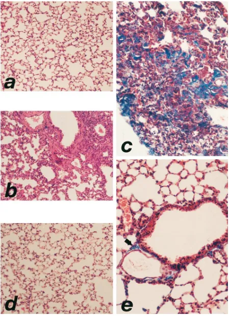 Figure 3. Representative photomicrographs of lungs demonstrating histological changes in response to administration of bleomycin and relaxin
