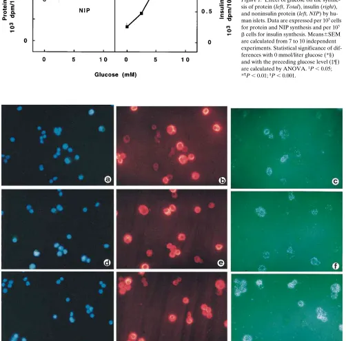 Figure 1. Effect of glucose on the synthe-*for protein and NIP synthesis and per 10sis of protein (left, Total), insulin (right), and noninsulin protein (left, NIP) by hu-man islets