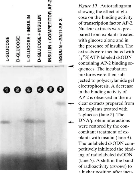 Figure 9. Gene expression of various ECM proteins, analyzed by quantitative RT-PCR. Lanes 1, 3, 5, and 7 represent amplified PCR products of cDNAs prepared from L-glucose–treated explants