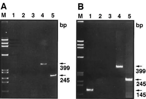 Figure 1. RT-PCR detection of cytokine mRNAs in wild type Th1 clones and IL-10–transduced Th1 cells