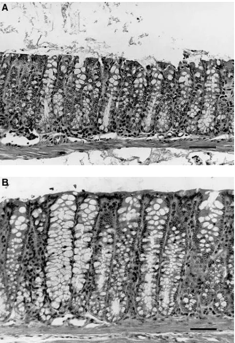 Figure 9. Histologic comparison of colonic mucosa. (sent 50 and A) Wild type. (B) hGAS transgenic