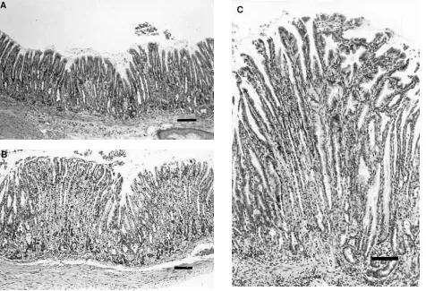 Figure 10. Histologic comparison of gastric mucosa. (A) Wild type. (B) hGAS transgenic