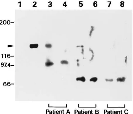 Table I. ELISA for Anti–ORP150 Autoantibody in Patient Sera