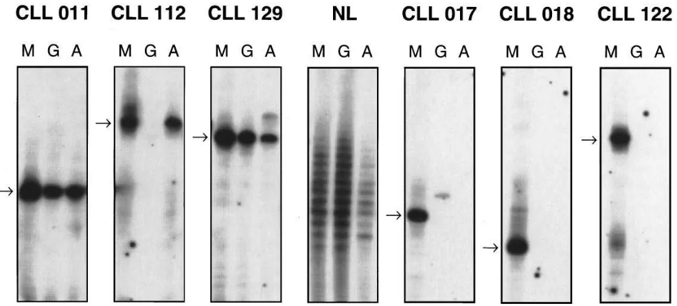 Figure 2. Comparisons of the cDNA sequences derived from the PBMC RNA of the IgM� CLL patient No