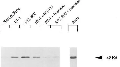 Figure 1. Endothelin-induced stellate cell activation in culture. Stel-rafotoxin S6C. A representative immunoblot is shown (late cells were isolated from normal animals as described in Methods