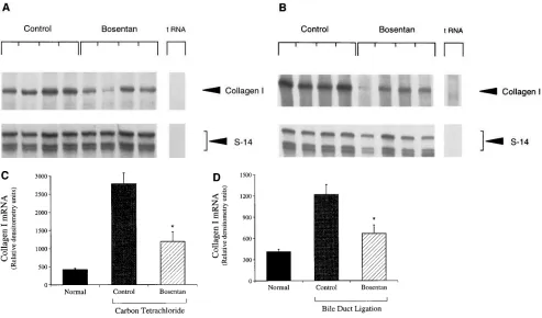 Figure 2. Bosentan reduces type I collagen mRNA expression during hepatic wound healing